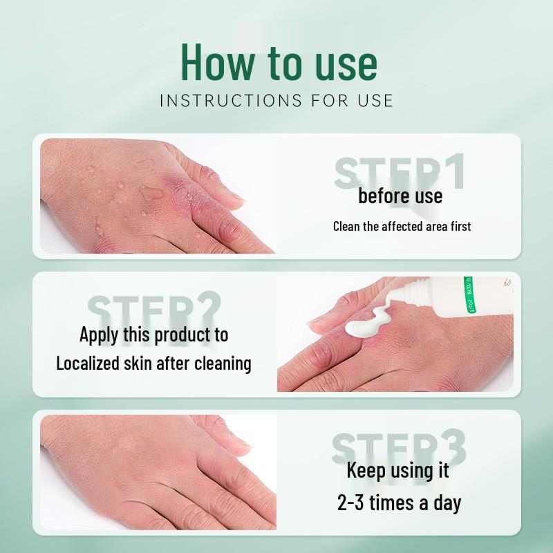 Tuo Neng Skin Care Ointment: Protects Against Acne, Dermatitis, Eczema, Non-Chronic Wounds, Cracks, and Chilblains.