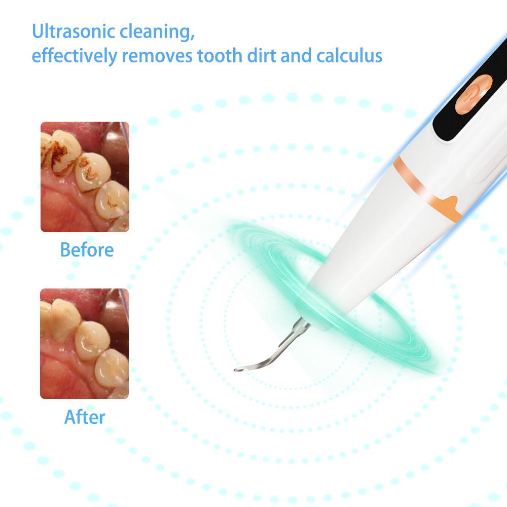 TEWIRROW Ultrasonic Electric Tooth Cleaner Calculus Remover Household Dental Scaler Remove Teeth Stain Tartar Plaque with Led 3 Modes