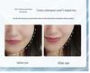 Ultrasonic Silicone Facial Cleansing Brush for Ladies