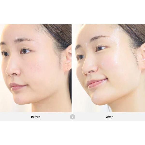 Rejuran Dual Effect Ampoule 30ml