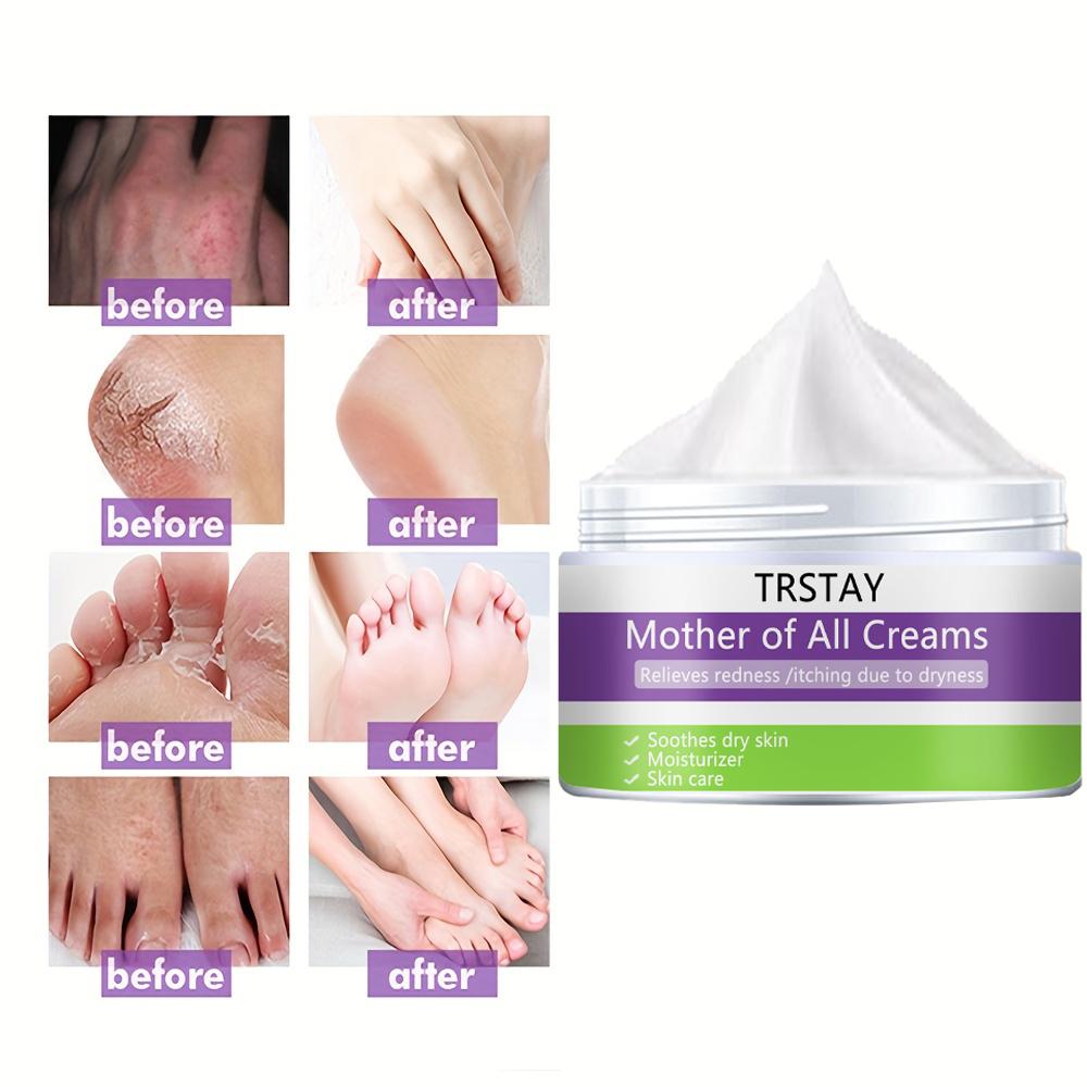 Cream Heel Cracked Repair Cream Removal Dead Skin Hand Care for Family Foot Treatment Feet Care