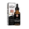 Fast Nail Fungal Treatment,nail Maintenance Nail Care Liquid Treatment, and Fungal Elimination On the Feet 30ml