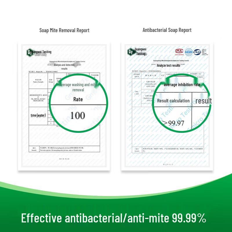 Dettol Mint Ice Refreshing Antibacterial Bar Soap - 3 Pack