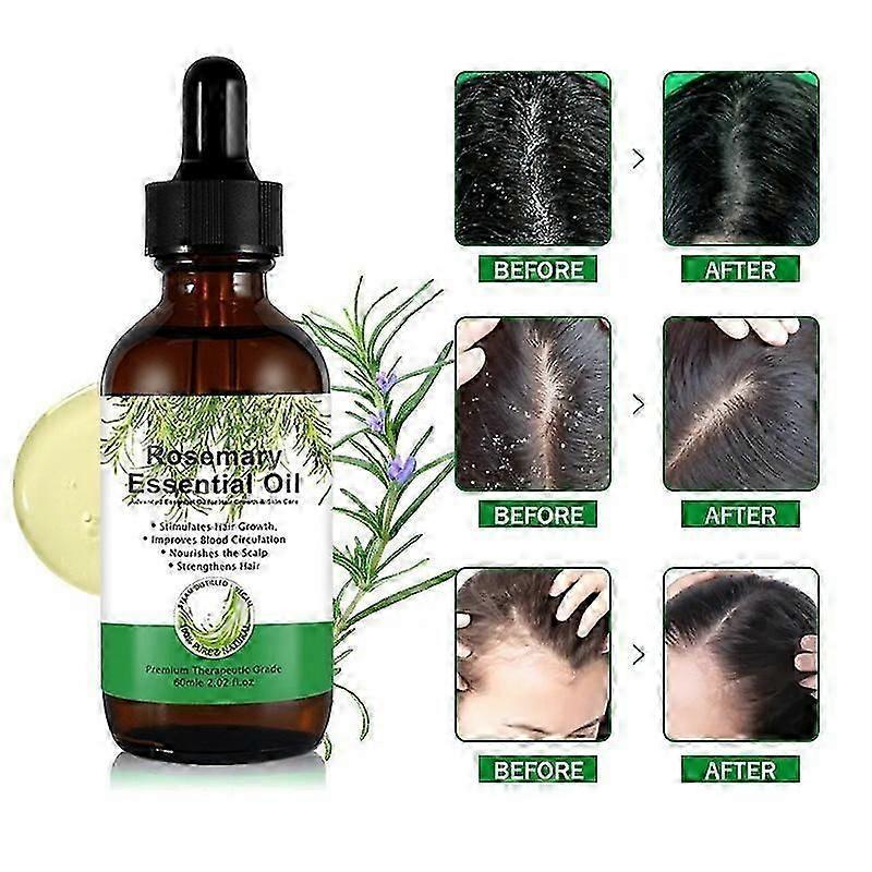 Veganic Natural Rosemary Oil For Hair Growth, Rosemary Essential Oils, Nourishes The Scalp, Stimulates Hair Growth 60ml