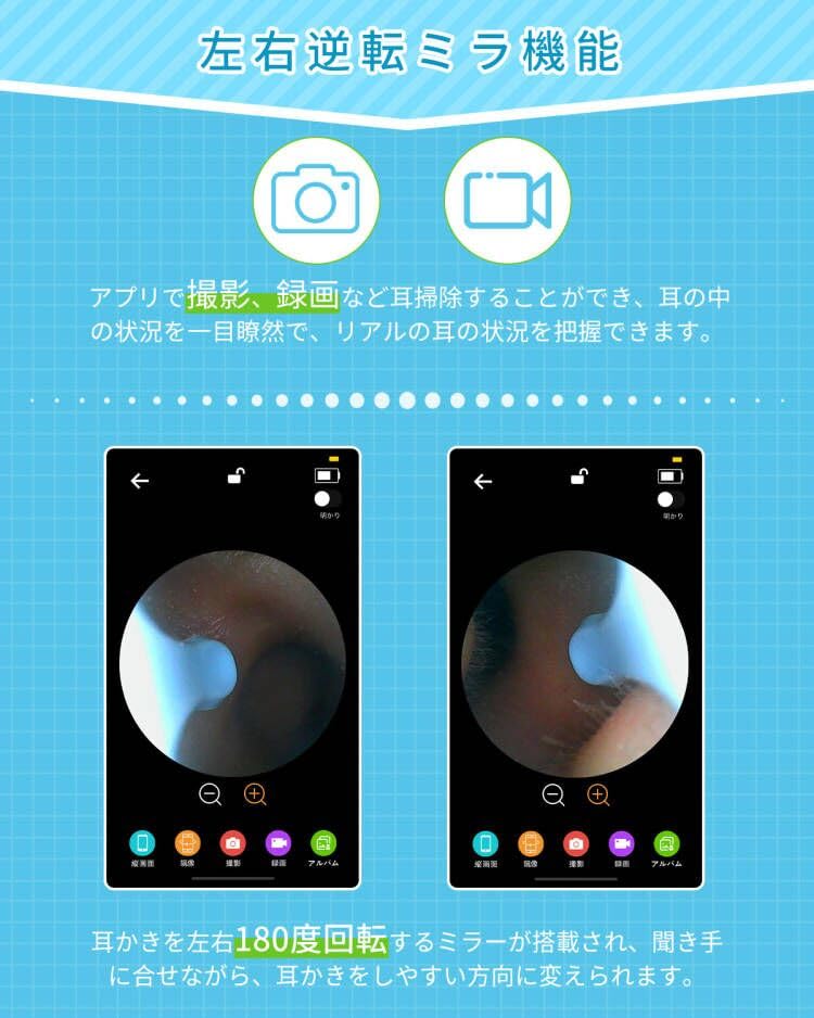 Wireless Ear Cleaning Camera with 5MP High Resolution Youmay Ear Cleaning Inversion Video Photo WIFI IP67 Ear Cleaning Ear Cleaning Earwax Cleaning