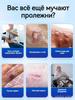 Cream for trophic ulcers and dry skin cracks
