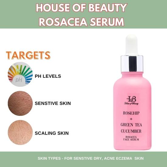 HOUSE OF BEAUTY Rosacea Serum - Rosehip, Green Tea, Cucumber for Face, Sensitive Skin Type, Redness, Dryness and Skin Stretching (30ml, Pack of 1)