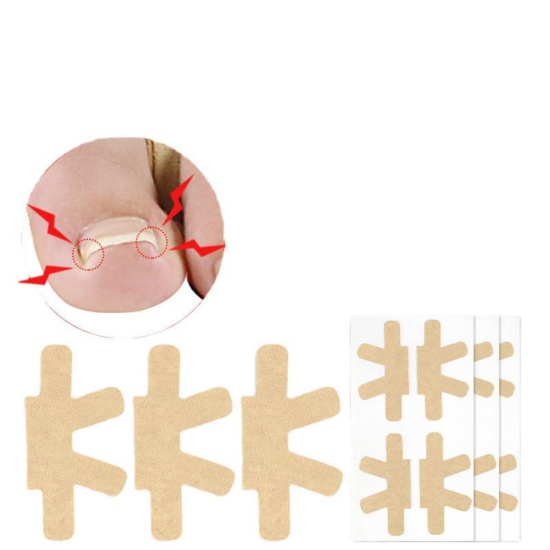 Nail Groove Device Patch, Toenail Patch Prevents Nails From Growing Into The Flesh, Pull Toenails Without Glue