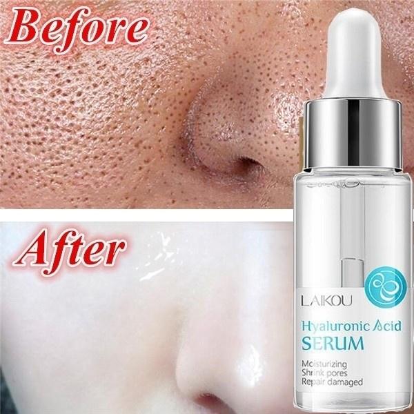 laikou hyaluronic serum