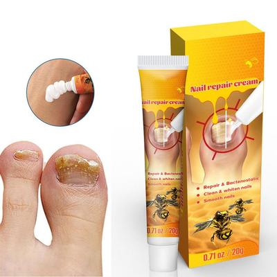 Nagelcreme Reinigt und Glättet Nägel Repariert Beschädigte Nägel Stärkt Nägel Fördert Die Nagelgesundheit Nährt und Befeuchtet Die Haut