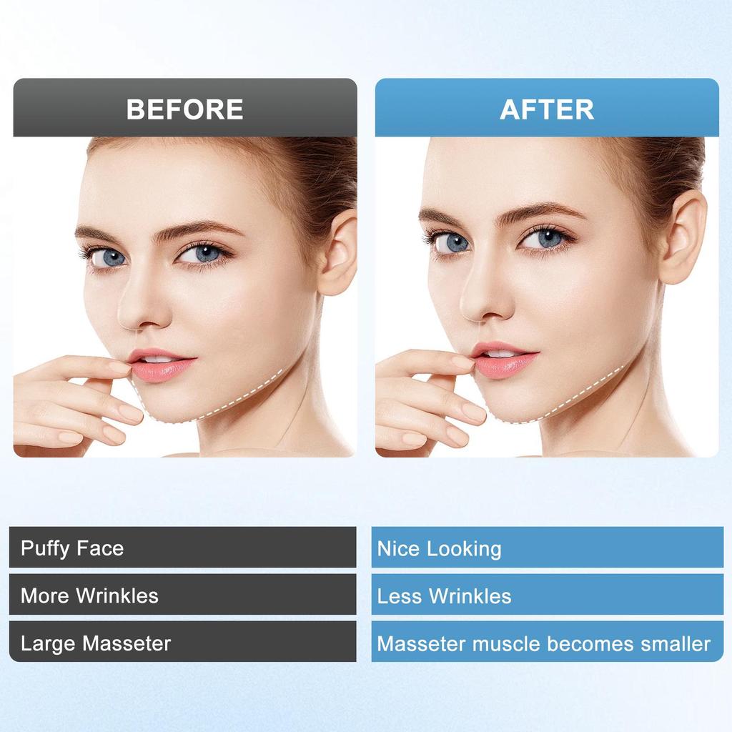 EMS Facial V-Line Massager: Microcurrent Lifting Beauty Mask