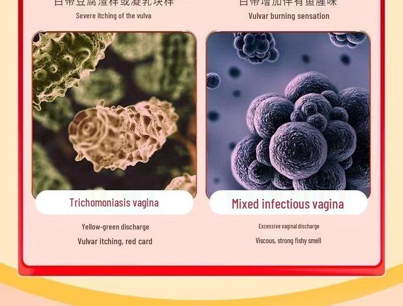 Baofukang HPV Defense Antibakterielles Gel für die weibliche Intimpflege