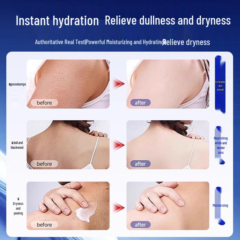 BEAUTY NOTES Urea & Fruit Acid Smoothing Body Cream