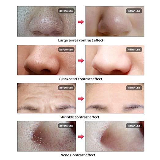 7 Colors LED PDT Phototherapy Mask Phototherapy Lamp Beauty Machine Treat Skin Tighten Facial Removal Acne Anti-Wrinkle 100-220V