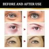 Eye Cream - Instant Tightening Eyelid Firming Cream for Anti-Aging Fine Lines & Under Eye Tightening
