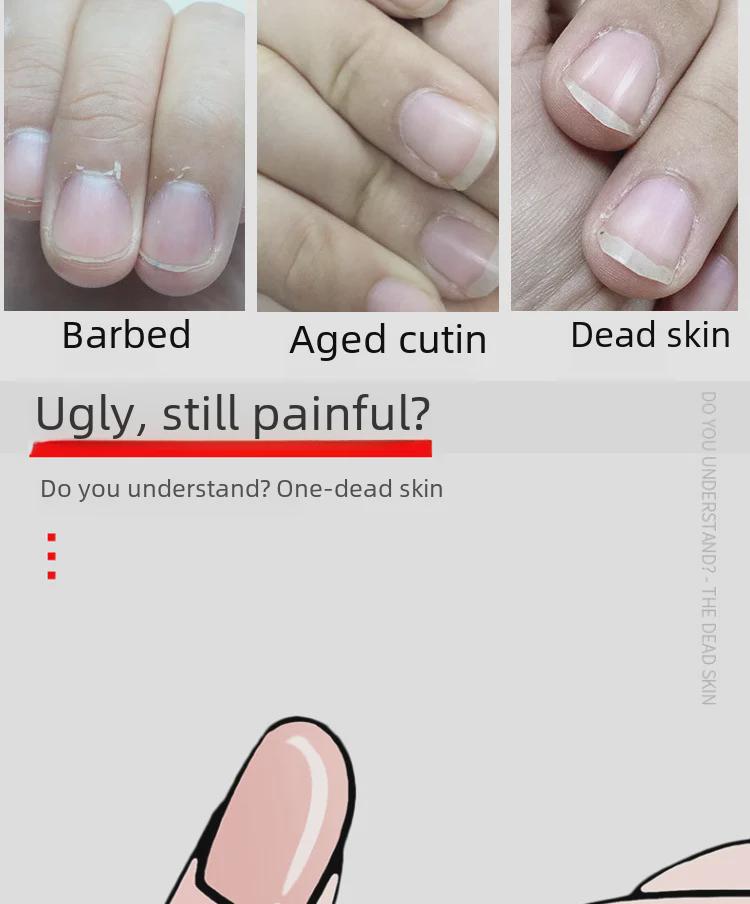 Xin's Professional Manicure Nail Scissors - Nail Scissors, Special Toenail Scissors, Dead Skin Removal Tools