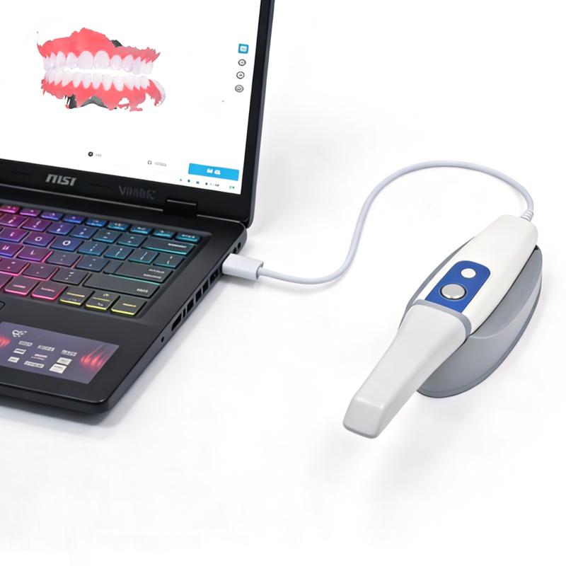 Scanner Intraoral 3D Dentar 3DS V5