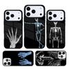 X-Ray Human Anatomy Phone Case For iPhone 17 AIR 16 Pro Max 15 14 Pro 11 12 13 Shockproof Silicone Cover