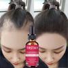 Hair Growth Serum Oil Fast Thick Natural Hair Care Scalp Reconstruction Prevent Hair Loss Damaged Hair Repair Products