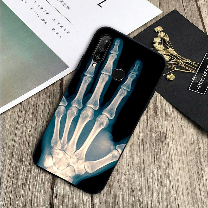 Skeleton Art For Huawei Nova 8i 11i 12i 12s 9 10 SE Y60 Y70 Y90 Y72 Y73 Y61 Y91 P60 Pro P30 P40 Lite Case