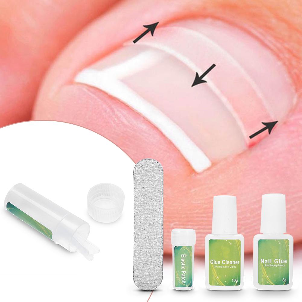 

Профессиональный набор инструментов для педикюра, триммер для ногтей на ногах, корректор вросшего ногтя, фиксатор, уход за ногами