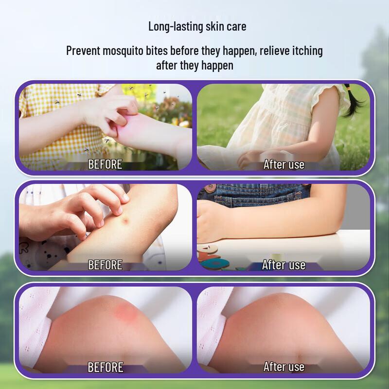 Herbal Comfrey Balm for Insect Bites