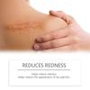 Skin Scar Moisturizing Care Stick: Smooths the Appearance of Skin Scars. Daily Care Cream