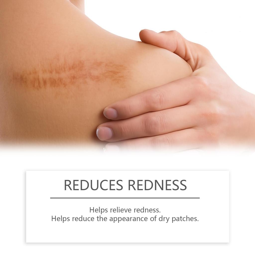 Skin Scar Moisturizing Care Stick: Smooths the Appearance of Skin Scars. Daily Care Cream