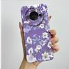 For Honor X9C Smart Phone Case X9cSmart Soft Silicone Funda Sweet Painted Fashion Cartoon Protective Capa Lovely Printing Cover