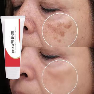 Hautaufhellungscreme, feuchtigkeitsspendende und Anti-Sommersprossen-Creme, repariert die Haut und Gesichtspflegeprodukte