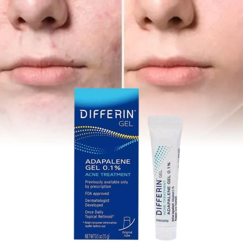 Differin Gel Traitement Acné Gel Rétinoïde Pour Peau Claire Radieuse 15g