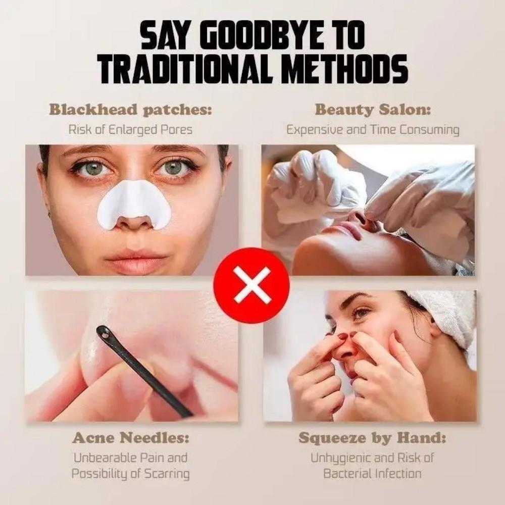 Non Damaging Pores Electric Pore Cleaning Adjustable Power Beauty Device  Facial Treatment