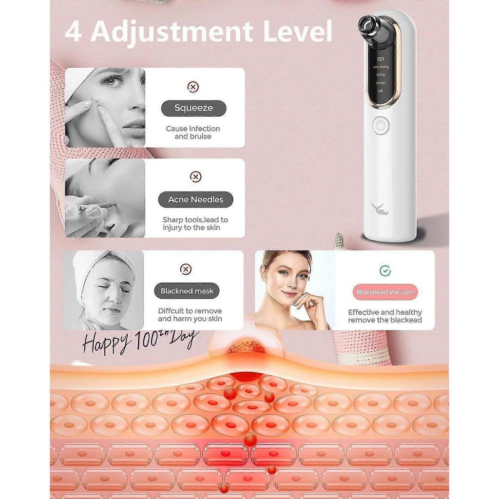 Blackhead Removal Vacuum, Blackhead Removal Tool with 4 Suction Probes, Blackhead Remover for Face, Cordless Pore Vacuum Acne Whitehead Remover, Black