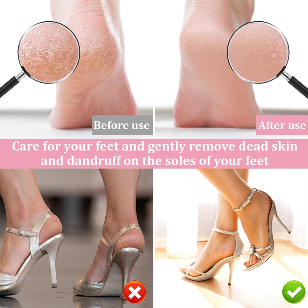 Electric Foot Callus Remover Adjustable Speed Callus Remover Foot Care Tool Remove Dry Hard Dead Skin Exfoliating & Foot Care