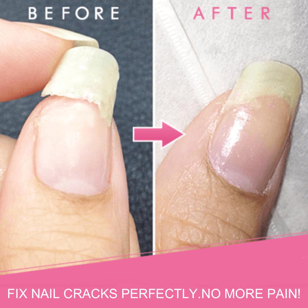 Nail Gels,5ml Cracked Broken Nails Extentions Repair Gel Treatment Manicure Base Coat
