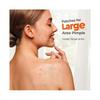 Large Pimple Patches, Acne Patches, Big Hydrocolloid Bandages for Body, Face, Forehead, Chin, Neck Zit Breakouts, Hydrocolloid Patch