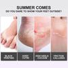 Lavender Exfoliating Foot Mask To Remove Dead Skin, Nourish Feet and Whiten Skin