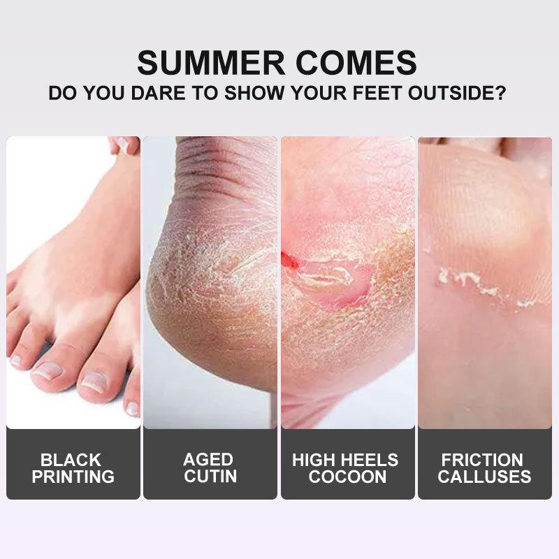 Lavender Exfoliating Foot Mask To Remove Dead Skin, Nourish Feet and Whiten Skin