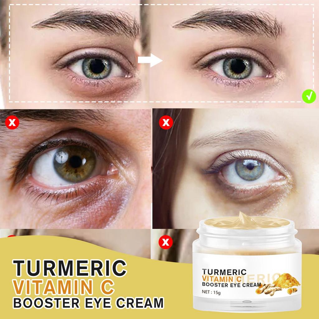 Curcumin VC Eye Cream VC Brightening Eye Cream Moisturizes Fades Fine Lines And Lightens Black Circles Under The Eyes
