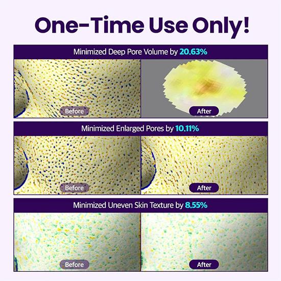 Dr.G Bakuchiol Pore-Jet Spicule Pads 30EA