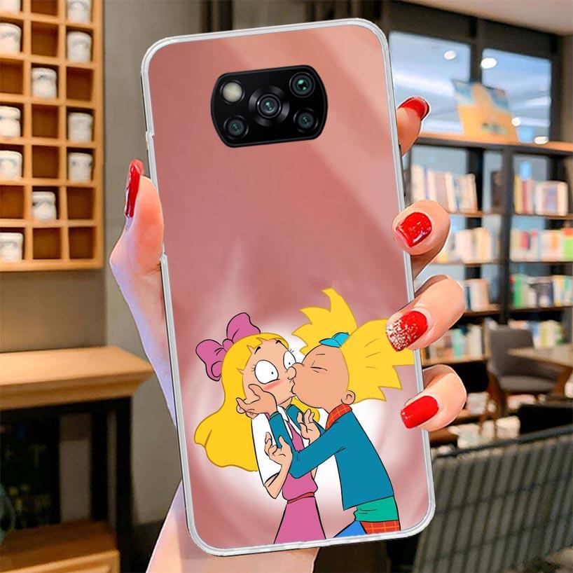 Cartoon Hey Arnold Fondos Cover Phone Case For Xiaomi Poco F7 Ultra X7 X6 X5 Pro M7 Redmi 15C 15 13C 13 12C 12 10C 10 9A 9C 9T 9