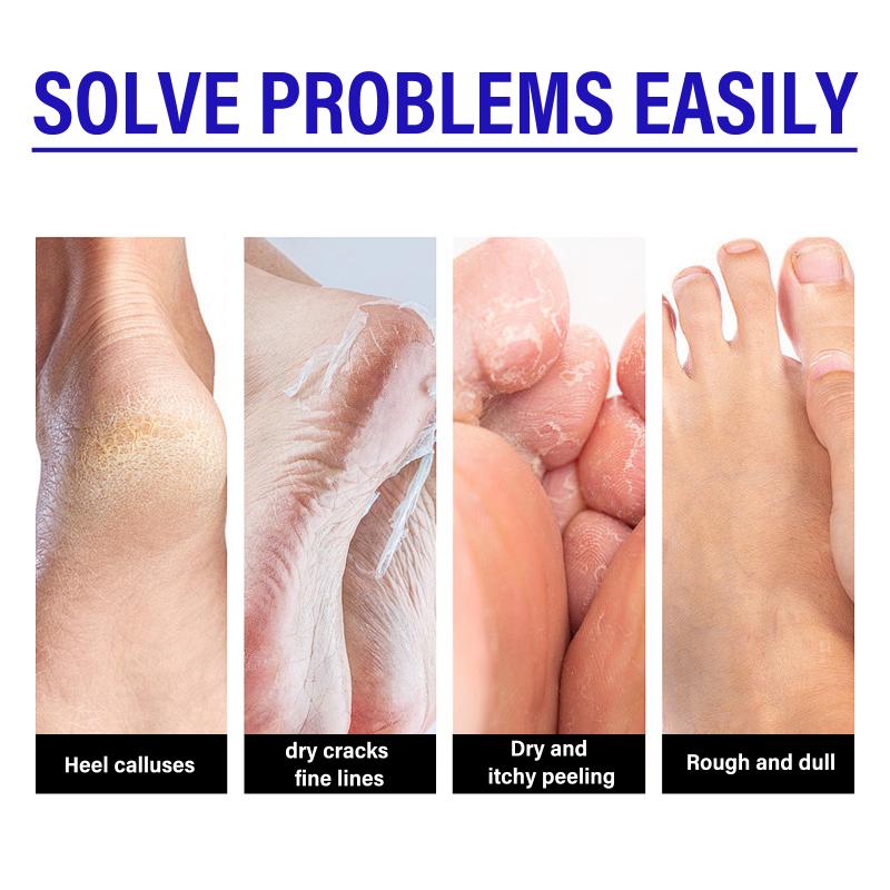Foot Care Cream, Gentle Exfoliating, Moisturizing, Daily Foot Care Cream For Heels.