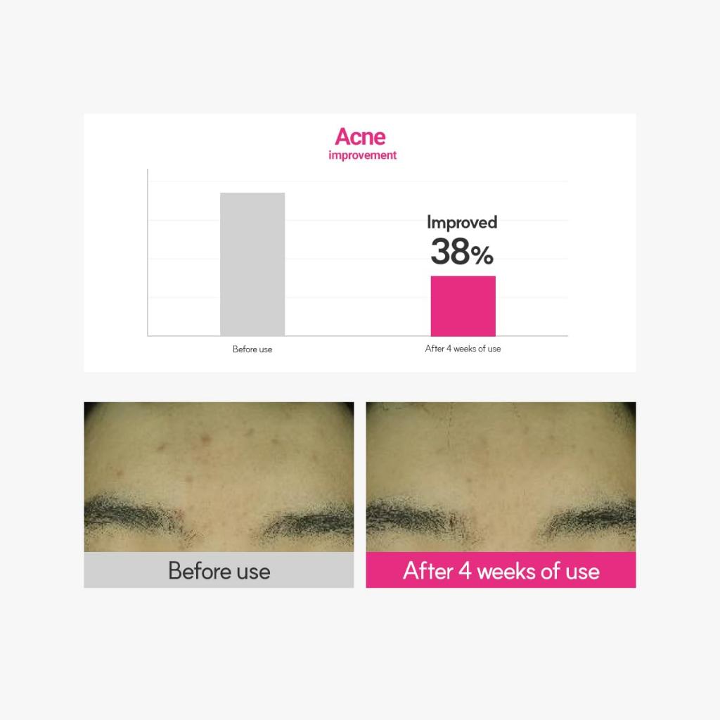 ROVECTIN Cica Care Blemish Clearing Cream 50ml