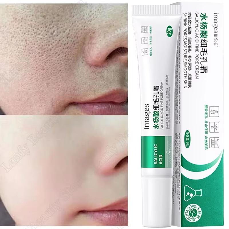 Crema Purificante Pori con Acido Salicilico Restringe i Pori Rimuove i Punti Neri Acne Illumina Idrata Pelli Lisce Cura della Pelle Prodotti Coreani