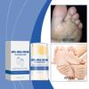 60% Urea Cream for Foot Use - Softens Dead Skin Cells, Naturally Exfoliates, and Provides Excellent Moisturizing Properties for Dry, Cracked Skin. Ide