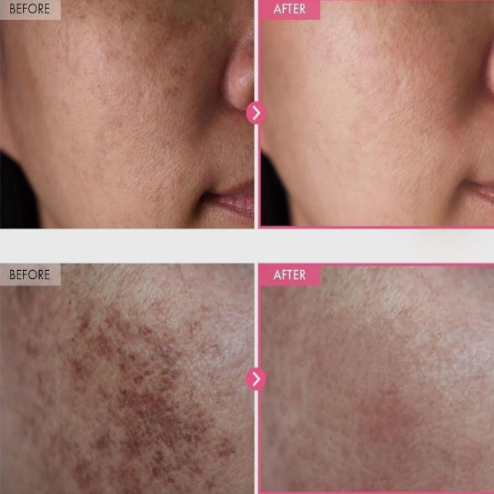 TOSOWOONGArbutin 7% Tranexamic Acid 4% Cream 50ml Brightening K-Beauty 50g