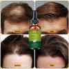 Onion Black Seed Hair Oil Spray for Hair Care and Growth To Prevent Hair Loss
