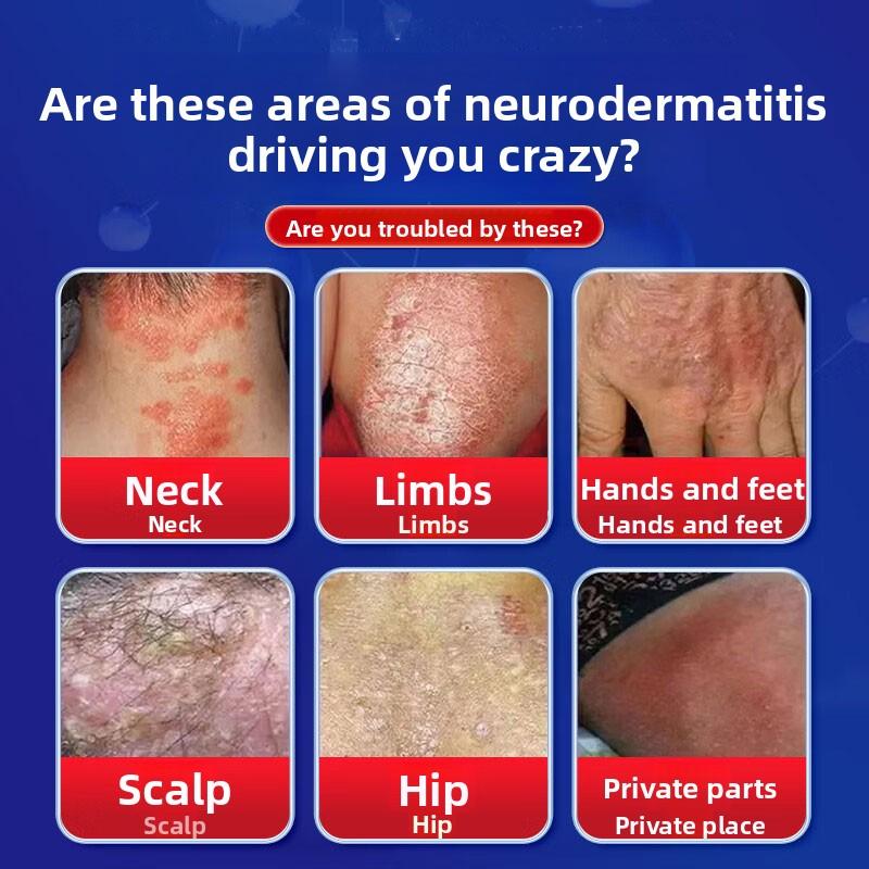 Gentle Skin Problem Gel - Herbal Extracts Relieves Eczema Dermatitis & Redness