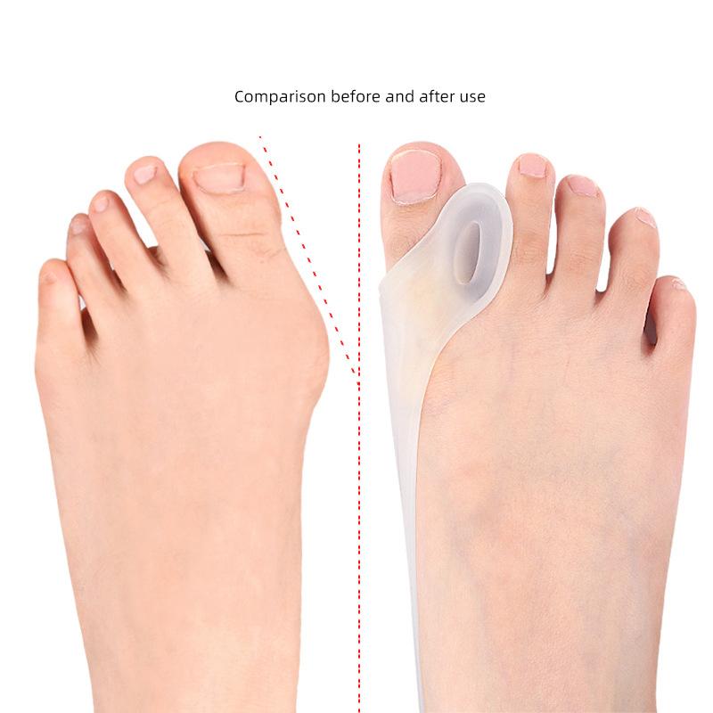 1PCS Silicone Gel Thumb Corrector – Bunion and Hallux Valgus Protector with Toe Separator for Foot Care
