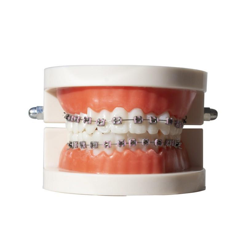 Multi-colored Metal Dental Braces Model for Outpatient Teaching and Practice Display